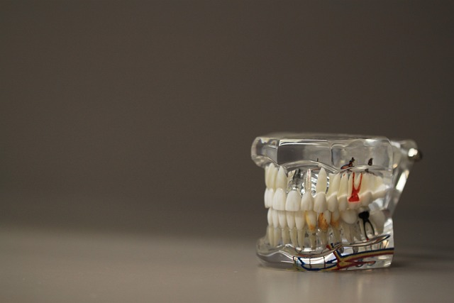 Protecting the tooth pulp is critical when performing ipr (interproximal reduction)