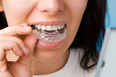 Invisalign Clear Aligners Smiling woman with straight, healthy teeth using an Invisalign clear aligner for orthodontic treatment to improve bite alignment and whiten teeth. Provided by Limestone Hills Orthodontics in Austin, TX.