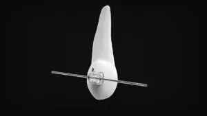 components of braces, including brackets, wires,