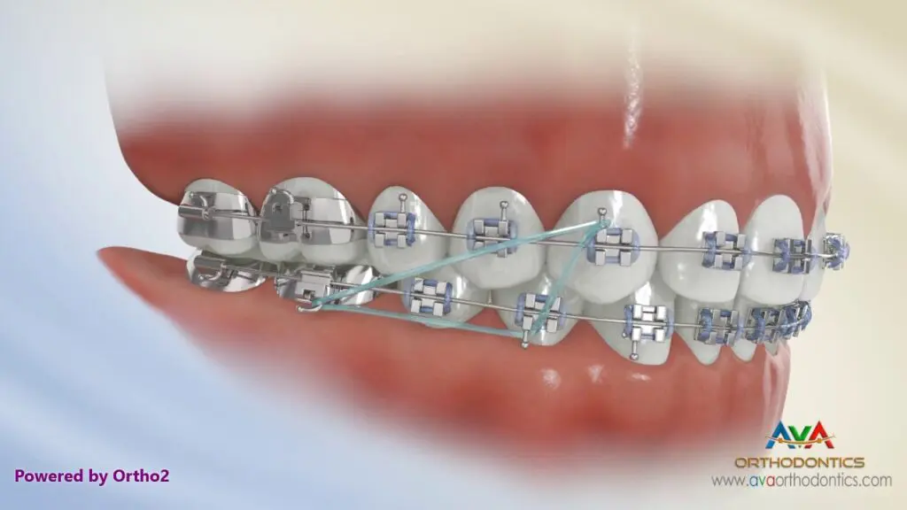close-up of a model of teeth