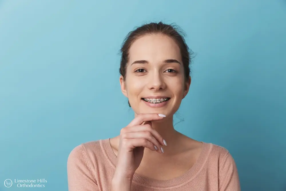 a woman with braces smiling. Aligners vs Braces in Austin, TX