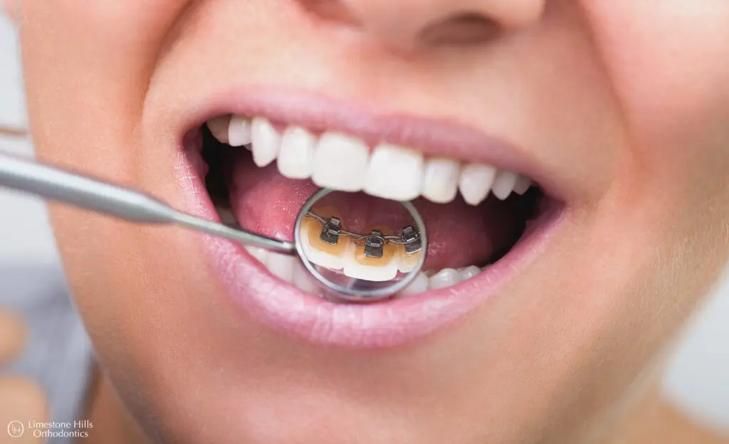Limestone Hills Orthodontics