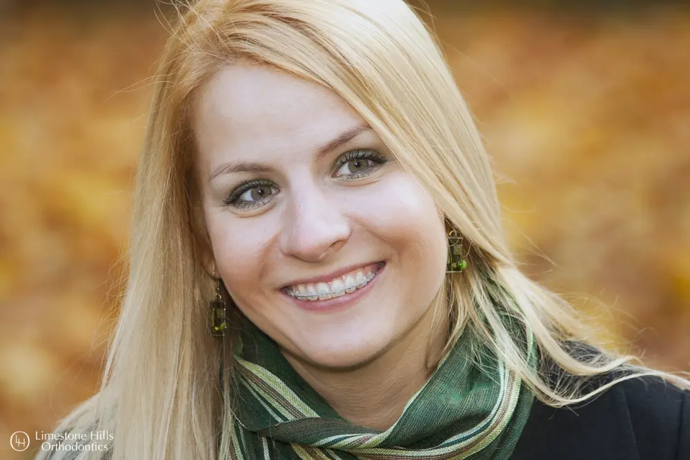a woman smiling at the camera. Clear Braces vs Metal Braces in Austin, TX