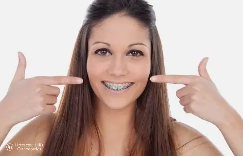 a woman pointing at her teeth with metal braces illustrating How To Clean Braces 