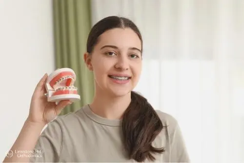 a woman holding teeth replica illustrating How to Get Braces Glue Off Teeth