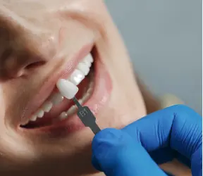 Close-up of a smiling patient undergoing a tooth shade matching process for a dental veneer or crown, performed by a gloved professional at Limestone Hills Orthodontics in Austin, TX.
