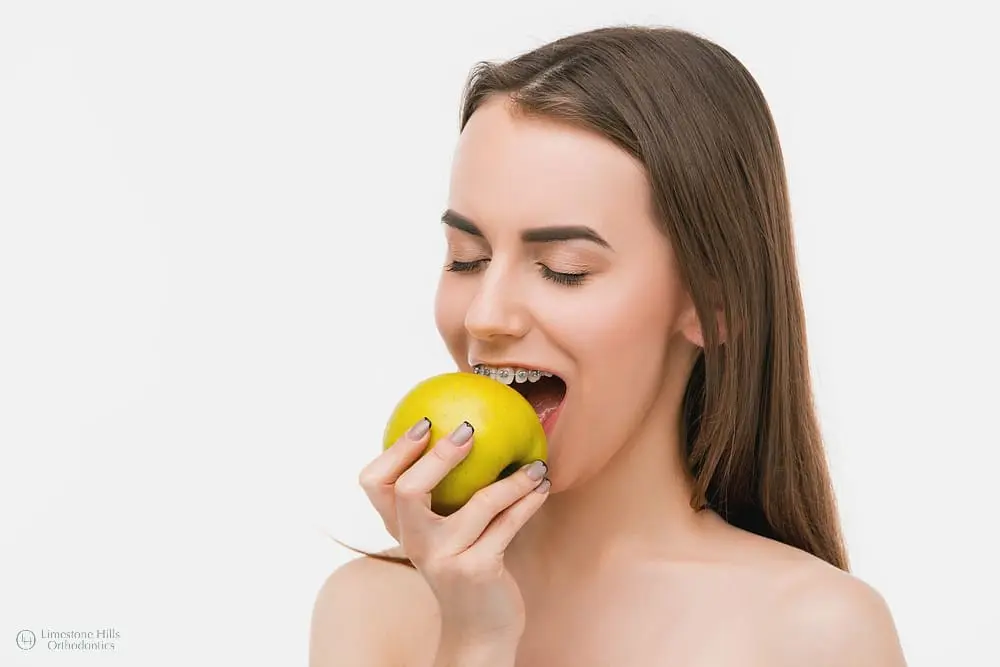 Beautiful young woman with metal braces smiling and biting an apple after knowing how to remove food from braces