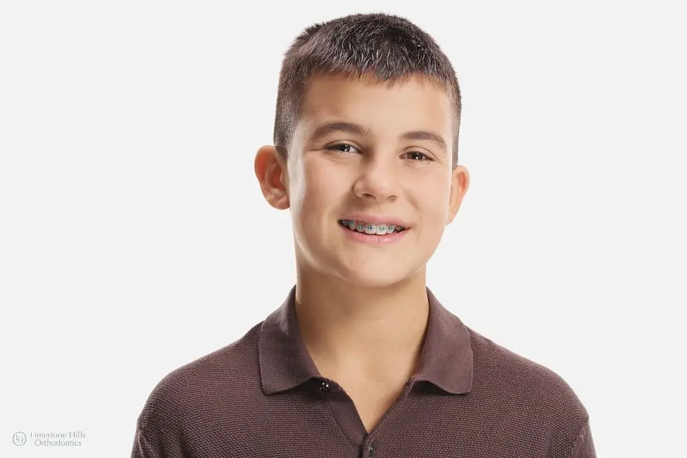 Cute boy going back to school with braces smiling, isolated on white background, orthodontic treatment focus