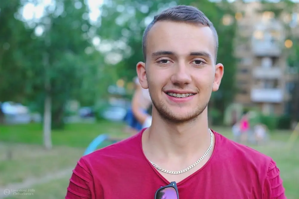 Young man with clear braces smiling outdoors, taking a break during a workout and sports with braces.