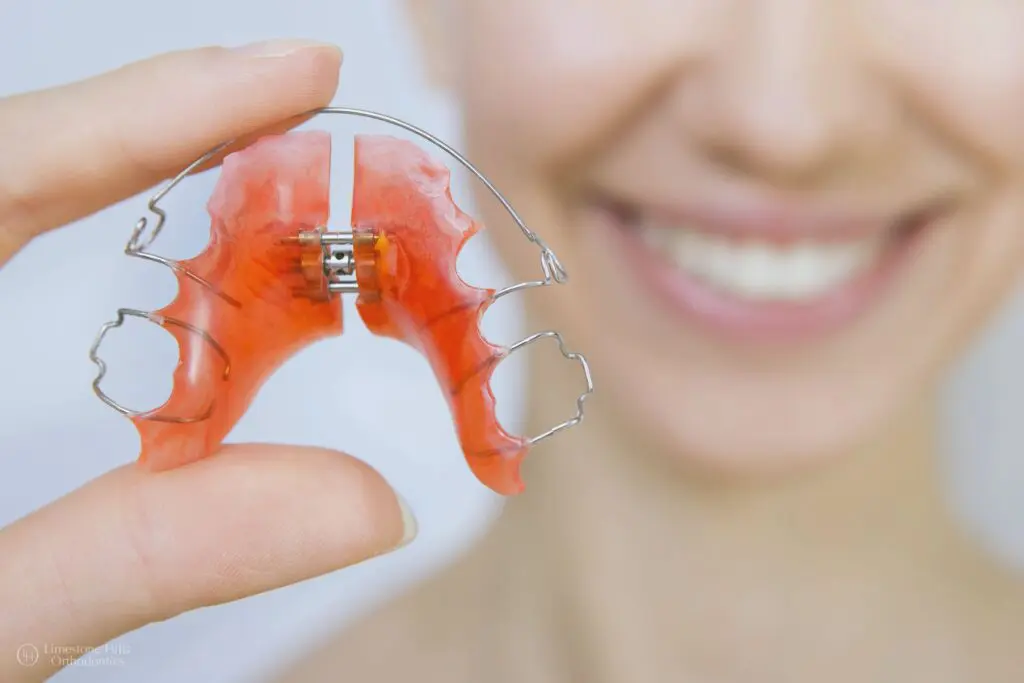 Smiling girl holding a set of braces for teeth, showcasing what happens when your retainer doesn't fit