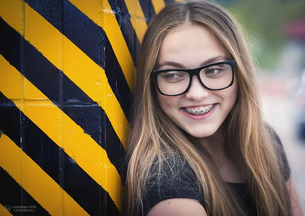 Smiling girl with metal braces posing against a bright yellow and black striped background after reading about Summer Survival Guide for Braces