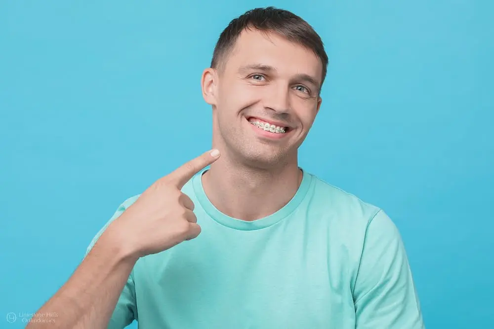 Happy young athlete pointing at his metal braces and smiling after doing sports with braces