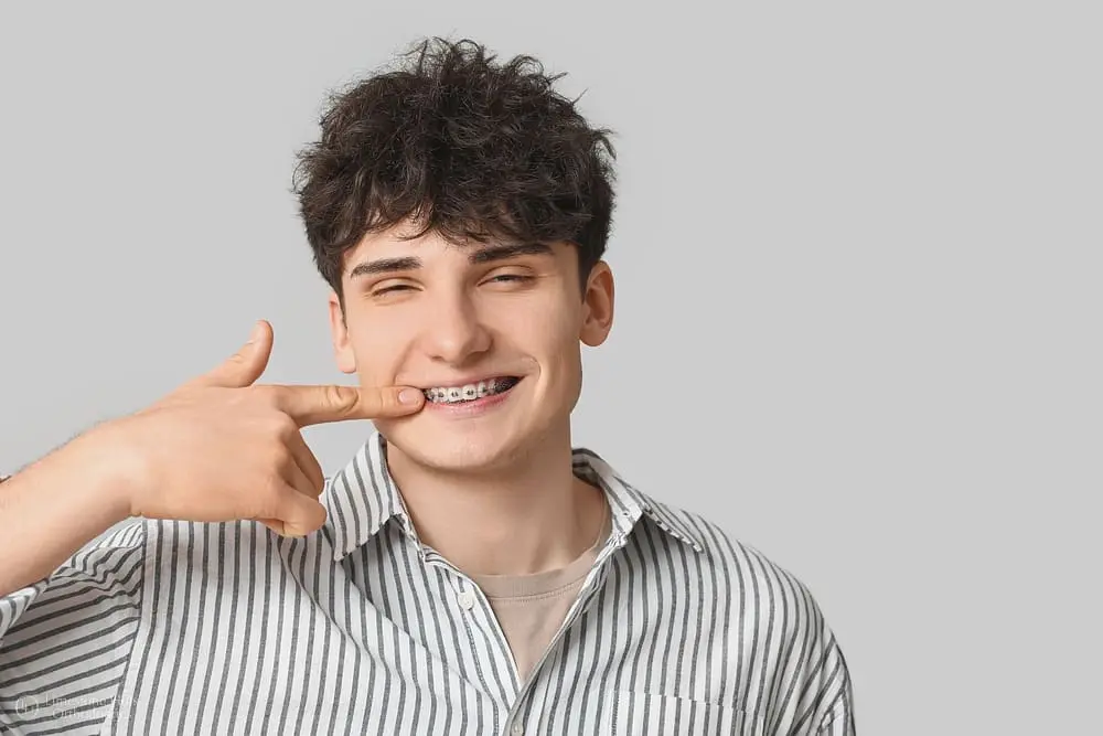 smiling young man metal braces light background after asking about "Will Braces Change My Face Shape?"