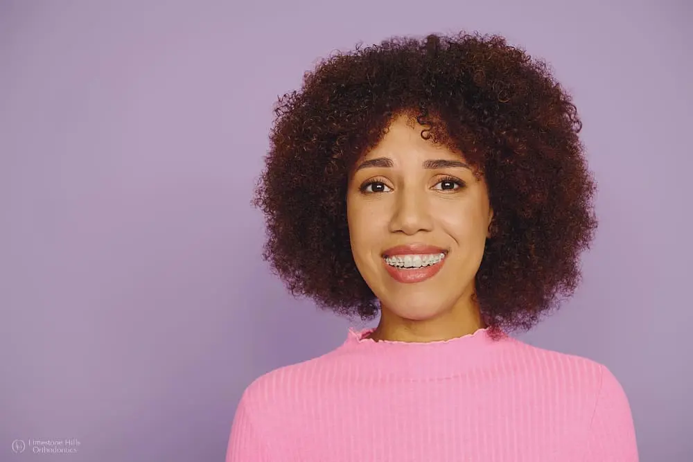 Spirited young woman with clear braces showcasing her happiness with a joyful expression after knowing about Facts About Adult Orthodontics