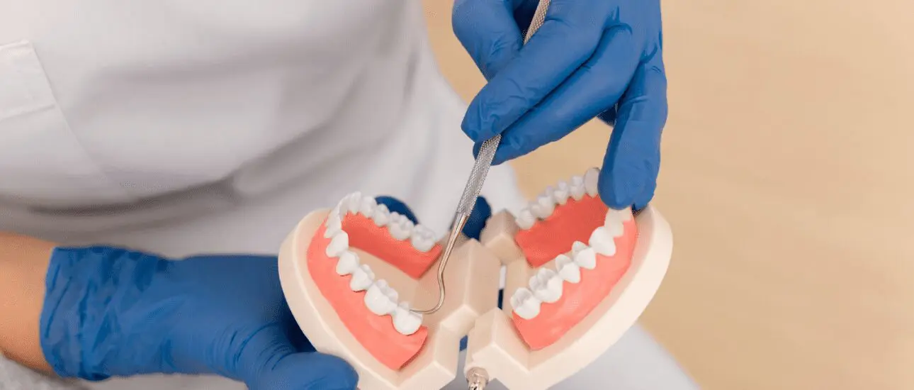 A close-up view shows hands wearing blue surgical gloves using a dental instrument to examine a model of upper and lower teeth. This could represent the diagnostic process and assessment of overbite severity conducted at Limestone Hills Orthodontics in Austin, TX.