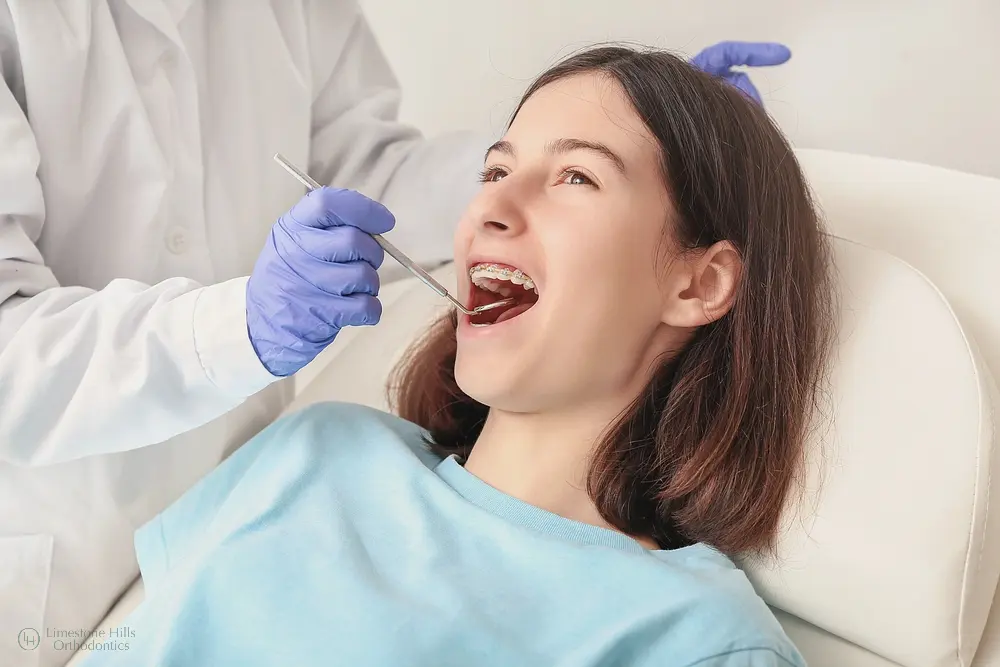 A young woman undergoing an orthodontic check-up as part of her treatment plan on how to fix overbite in Austin TX.