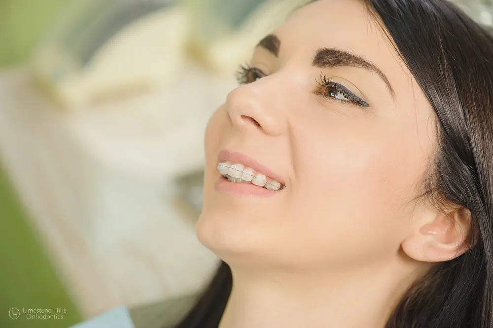A woman reclines comfortably in a dental chair during a consultation focused on how to fix overbite in austin tx using orthodontic solutions.