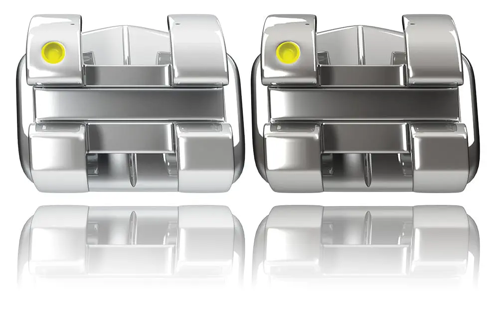Close-up of traditional metal braces with four silver brackets, including two with yellow indicators, used at Limestone Hills Orthodontics in Austin, TX for orthodontic treatment.