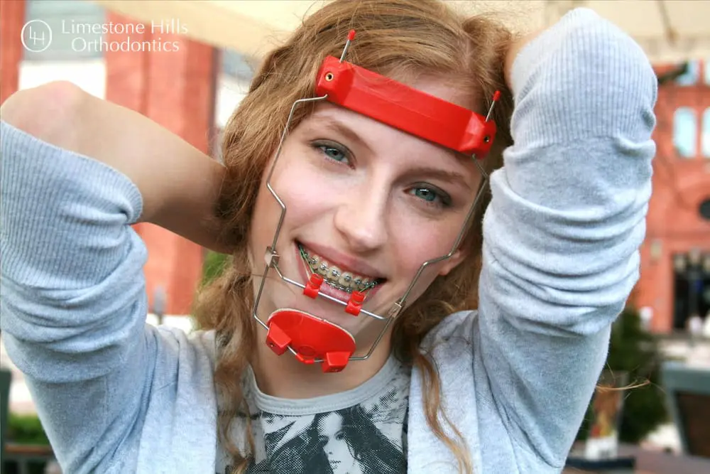Smiling person wearing headgear and braces, representing Understanding the Jaw’s Role in Facial Aesthetics at Limestone Hills Orthodontics in Austin, TX.