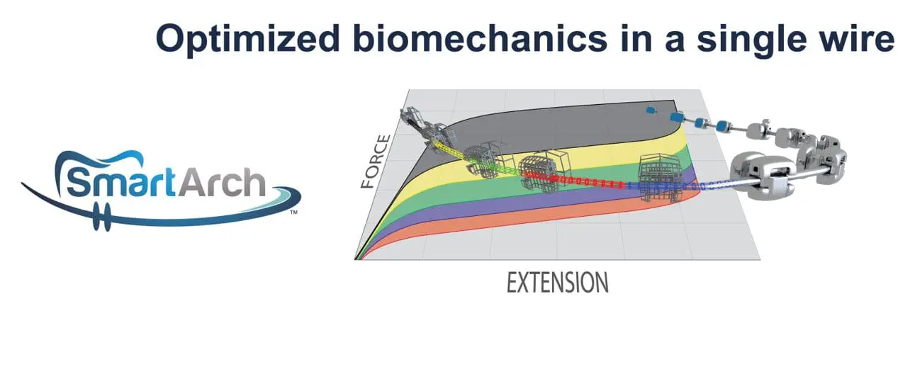 SmartArch™ technology biomechanics diagram with force-extension graph at Limestone Hills Orthodontics in Austin, TX.