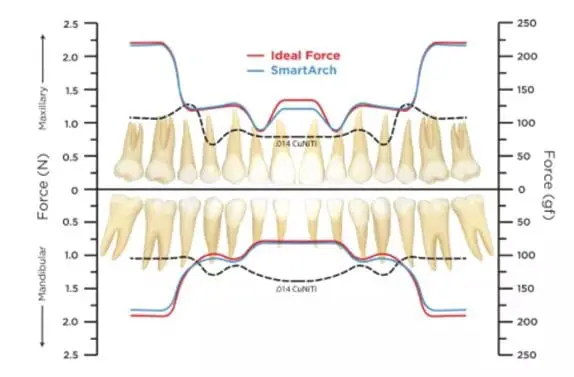 SmartArch™ force curve graph vs traditional braces at Limestone Hills Orthodontics in Austin, TX.