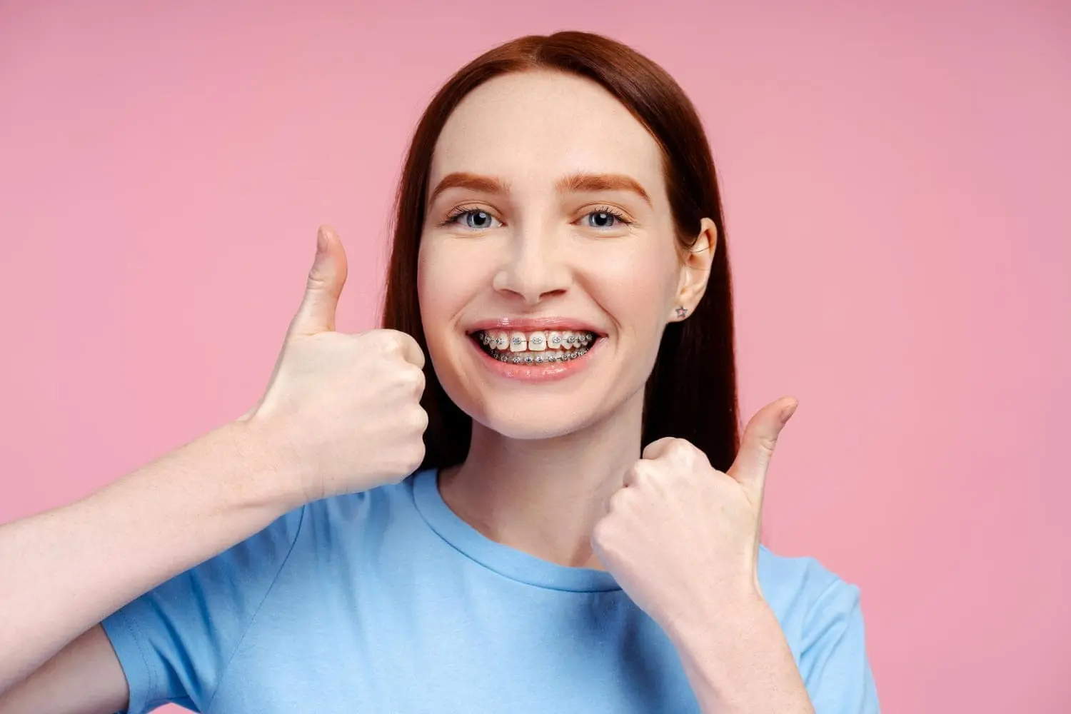 Traditional metal braces used for effective teeth alignment at Limestone Hills Orthodontics in Austin, TX.